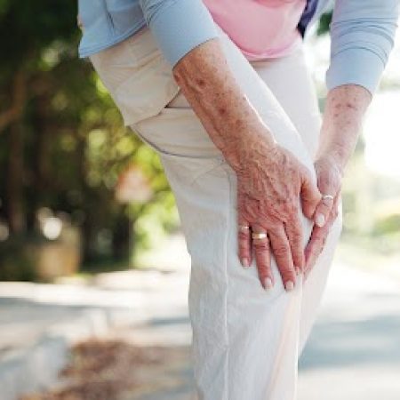 Senior woman, hands and fitness with knee injury for accident, emergency or pain in road. Elderly, female person or leg with ache, sprain or bone for muscle tension, fibromyalgia or bruise in street