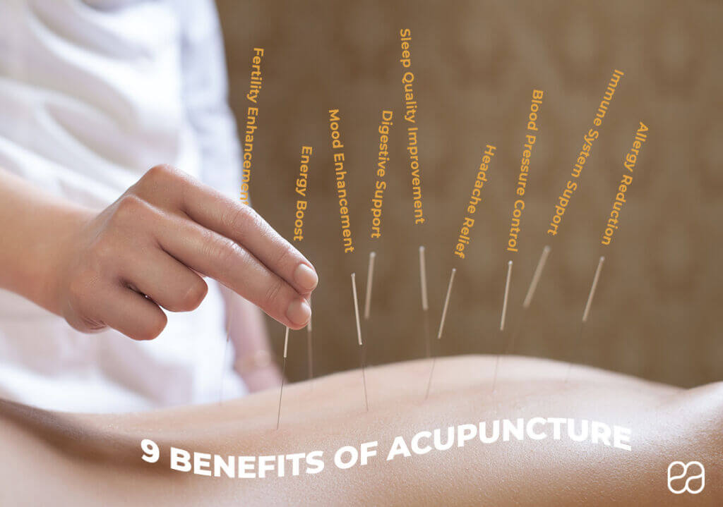 What is Acupuncture? How it works and The Benefits Endoca© CBD